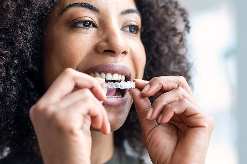 Invisalign® Clear Aligners in Carrollton