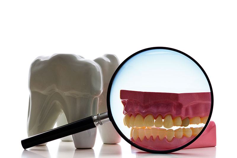 Endodontics in Carrollton