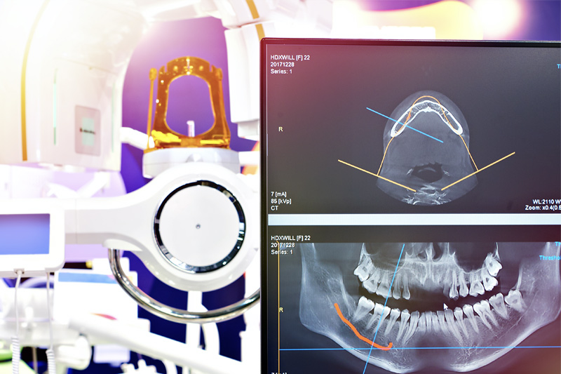 Digital X-rays and CAD scans in Carrollton